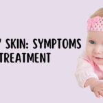 Dry Skin Remedies for Babies