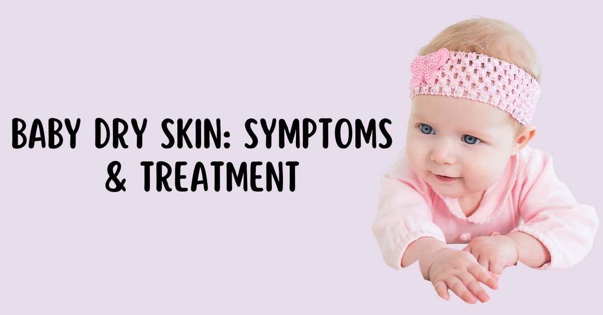 Dry Skin Remedies for Babies